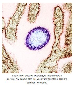 VIRUS NIPAH (Niv)